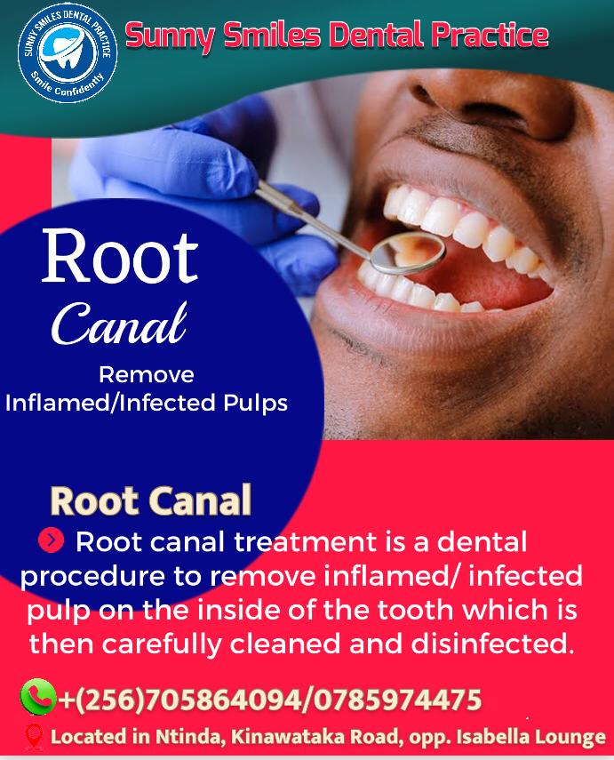 SmilesPractice's tweet image. Come to Sunny Smiles Dental Practice and have your teeth repaired. We are located in Ntinda Kiwatule Rd opp Isabella lounge
Make an appointment on 0705864094/0785974475
#dentalclinic #dentalcare #MbiddePayMartha #ebilet #TaylorSwiftErasTour #inflation #TheErasTour #تركي_آل_الشيخ