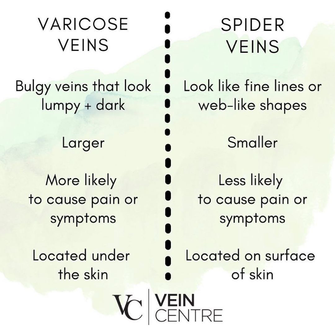 Varicose vs. Spider 💭⁣
⁣
Do you know the difference?!?!⁣
⠀⠀⠀⠀⠀⠀⠀⁣
#varicoseveins #varicoseveintreatment #spiderveins #spiderveintreatment #VascularHealth #varicoseveinspecialist #veinspecialist #health #nashvillehealth #veinhealth #veindisease #nashvilleveintreatment