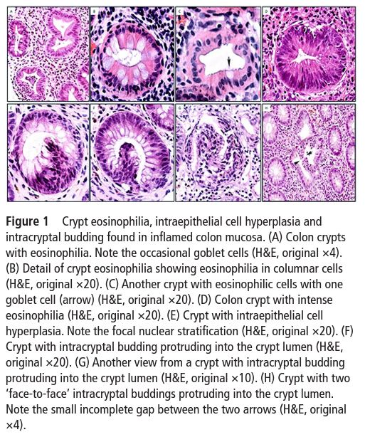 JClinPath_BMJ tweet picture