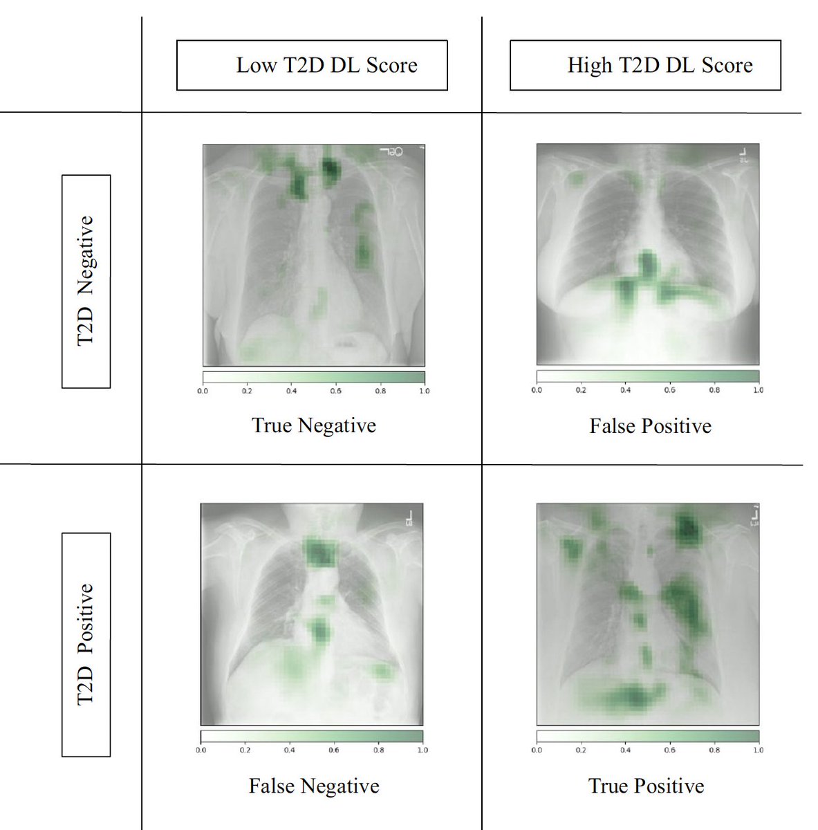 EricTopol's tweet image. There's been a burst of new medical #AI papers and reports. I've summarized them here and their significance, Part One
erictopol.substack.com/p/medical-ai-i…
(N.B. This and any substack post will be algorithmically suppressed by twitter. If you want to know they exist subscribe for free)