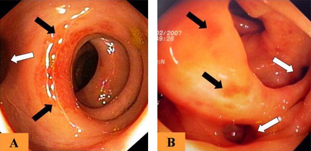 Keith Siau tweet media