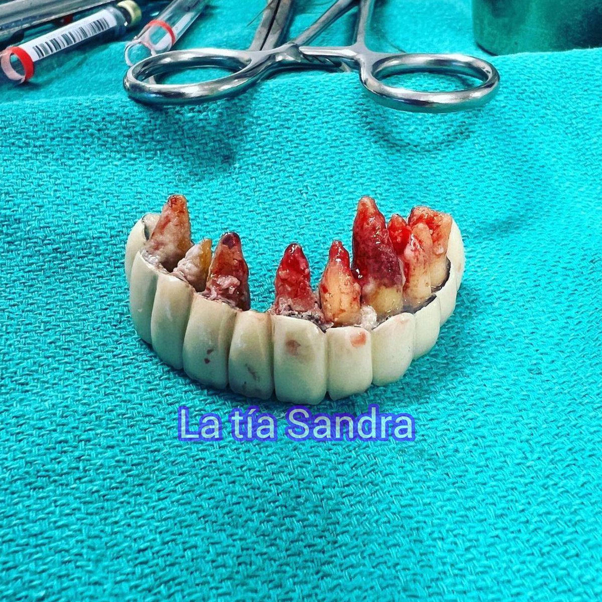 TuTiaSandra's tweet photo. 🦷Lista la dentadura de #GalileaMontijo para la gala de hoy en #LaCasaDeLosFamososMx
#LCDLFMX #corega https://t.co/Szl6VRJgH3