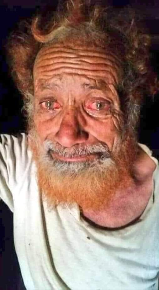 طعم المرارة الذي ينتشر في فمك بعد صمتٍ طويل ،
ما هو إلا دم الكلمات التي لم تقلها .
#إلى_متى
#عيدروس_شعبك_يُعذب