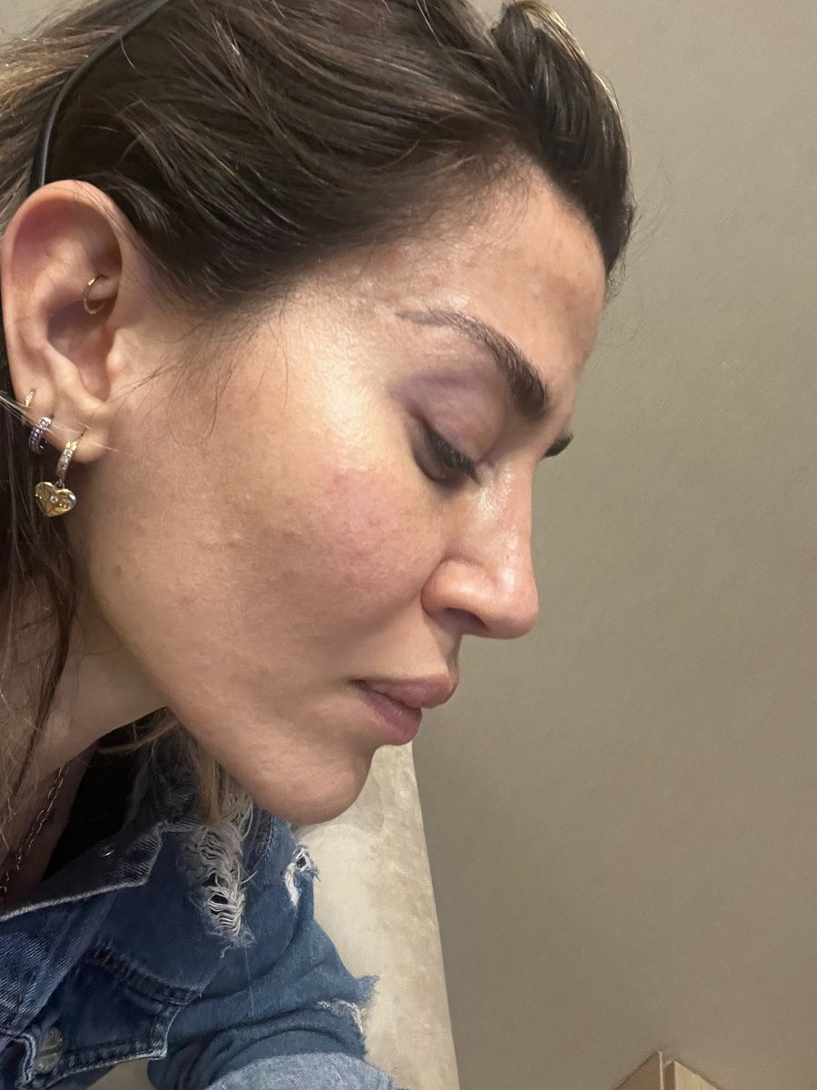 ᒎ 𝗠𝗘𝗡𝗔 tweet media