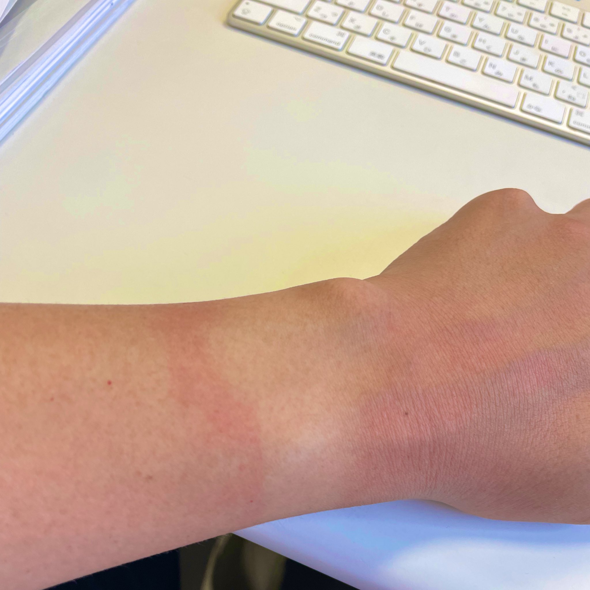 焼けた - Search / X