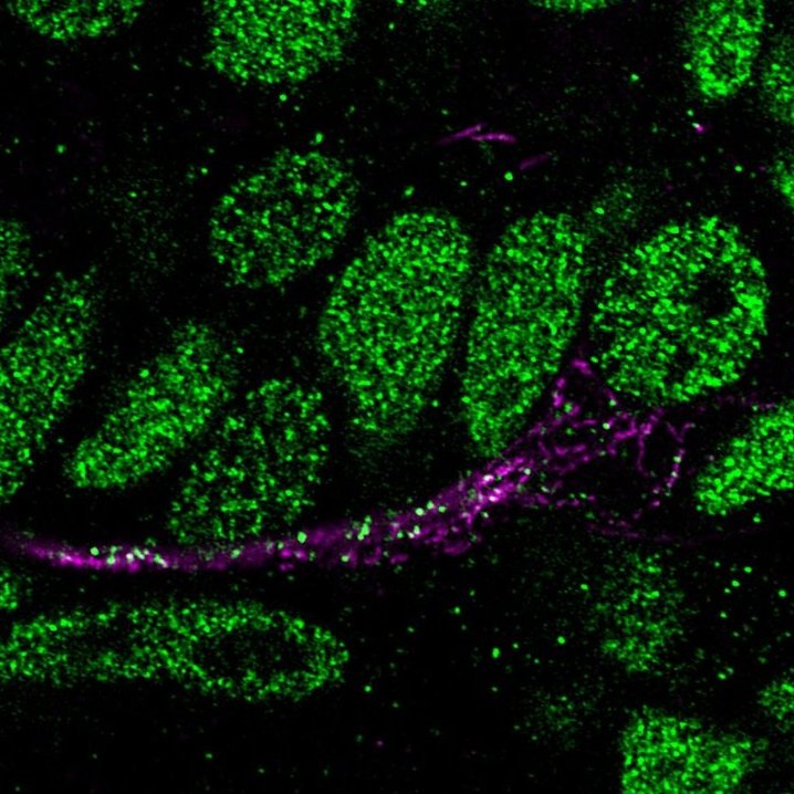Rachel Moore (@rach_e_moore) on Twitter photo I'm looking forward to presenting recent work from <a href="/HouartLab/">Houart Lab</a> at <a href="/EZM2023/">12th European Zebrafish Meeting 2023</a> this afternoon! I'll be talking about tagging endogenous axonal RNA splicing proteins for live imaging #EZM2023 I'm looking forward to presenting recent work from <a href="/HouartLab/">Houart Lab</a> at <a href="/EZM2023/">12th European Zebrafish Meeting 2023</a> this afternoon! I'll be talking about tagging endogenous axonal RNA splicing proteins for live imaging #EZM2023