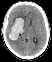 wisitalia's tweet photo. La soluzione di ieri era: ICTUS🧠
Gioca oggi con WIS 🤯
🙃 https://t.co/DyK5UkM5Qq
#SurgeryIsWhy https://t.co/dnIiGXkWb8