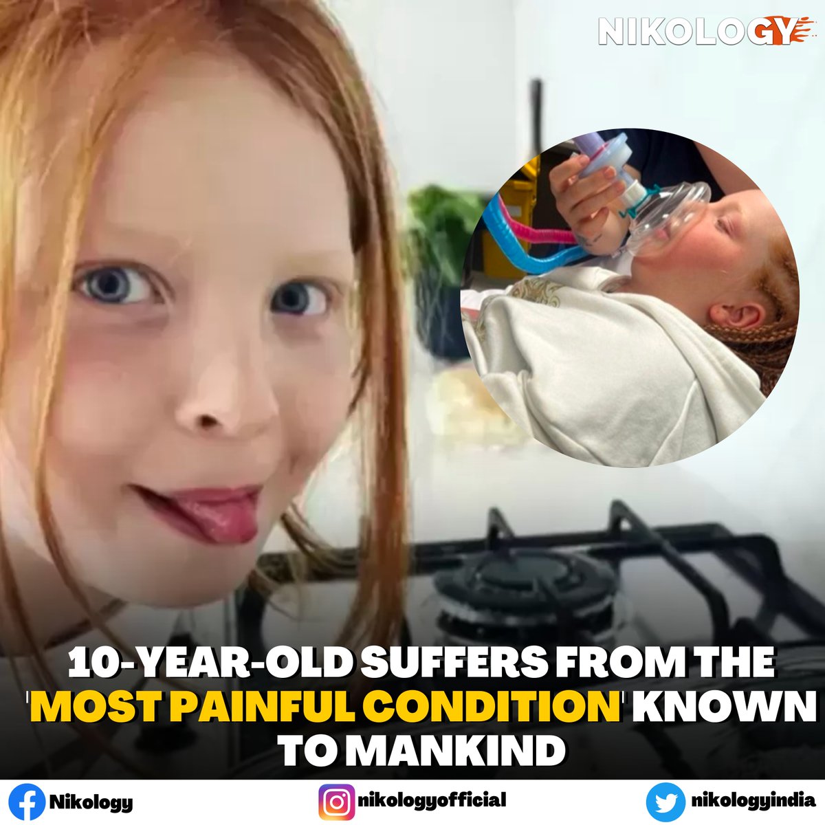 nikologyindia's tweet photo. Bella Macey, a 10-year-old kid from Australia, is suffering from complex regional pain syndrome (CRPS), often regarded as the “most painful condition” known to mankind.
#australia #child #pendamic #fiji #crps #human #mankind #vacation #australian #family #nikology #mehersheikh https://t.co/k1kBB5RYoE