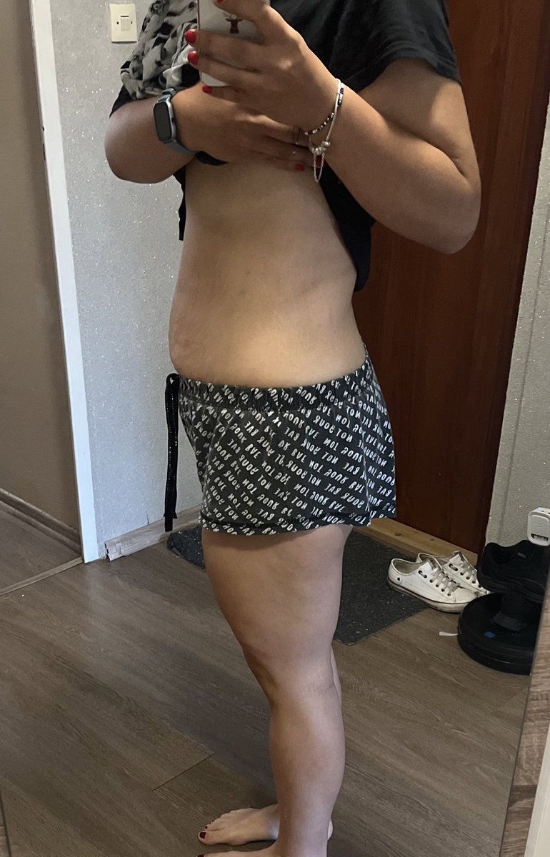 PlWeightloss's tweet photo. Troszkę ostatnio odpuściłam, dowaliłam 1,5kg
Ale wracam do zdrowego jedzonka i ćwiczeń 
▪️ 13/07/23 - 90,4
#fitlipiec https://t.co/5wfq0qzBoj