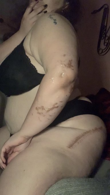I&rsquo;ve got scars on my left hip, left arm, right hand, and right foot from surgeries, but I think they<a href="/tag/shibari"class="tags"><span>#shibari</span></a>