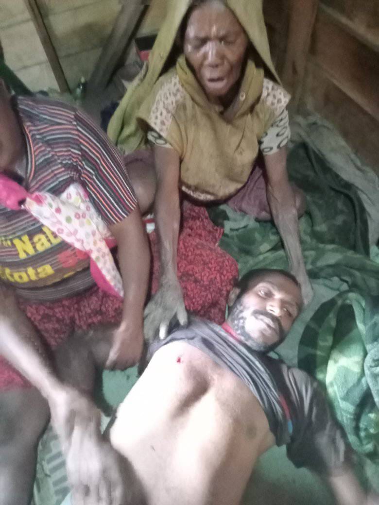 Lupasaya7's tweet photo. Brimob menggunakan 2 mobil kembali menembak warga sipil Yosia Keiya (20) di Dogiay tanpa, Papua di pinggir jalan Idakebo hari ini (13/07). Menurut saksi, korban ditembak tanpa alasan penyebab. Hallow @jokowi  apakah ini yg anda sebut aman? https://t.co/hI2TsoiT7S