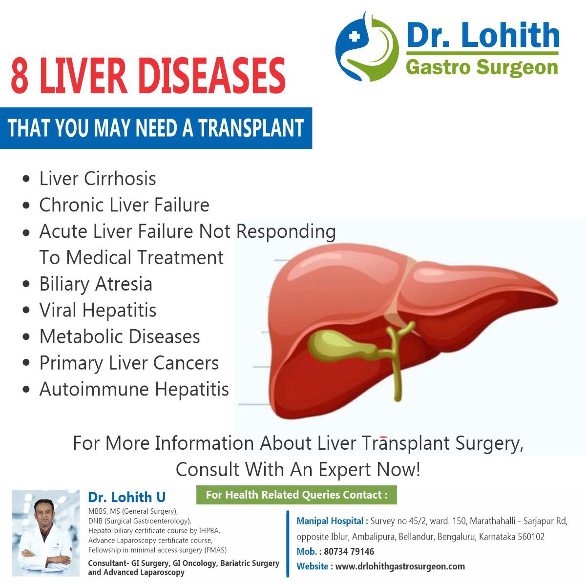 8 Liver diseases that you may need a transplant

Best liver transplant treatment in Bangalore 

#drlohithu #lohith #Sarjapur #liver #livertransplant #liverdiseases #livercancers #metabolicdiseases #livercirrhosis #sleepearly #viralhepatitis #gastroenterology #gastrocare