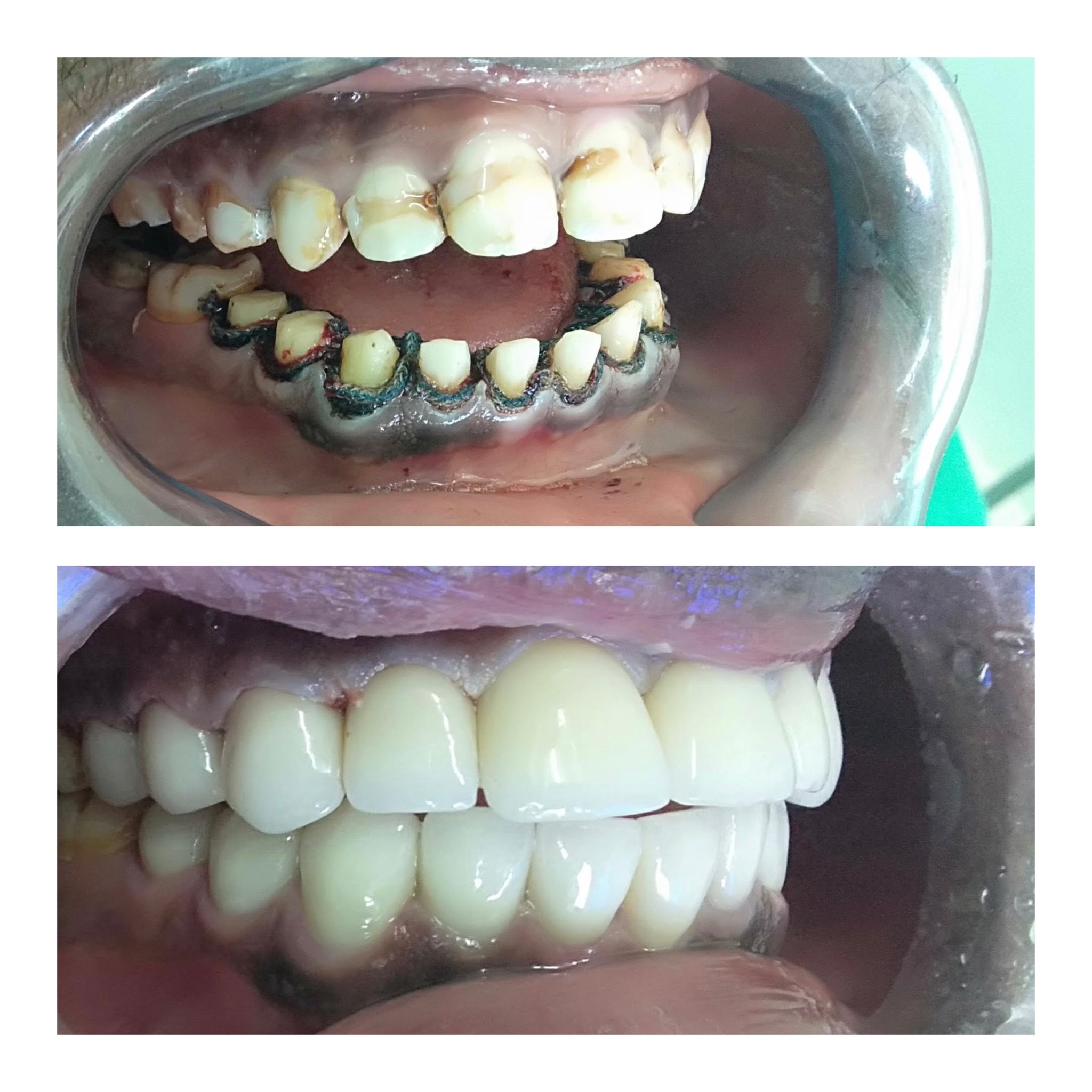 Arrow Dental Centre on Twitter "Hold the vision. Trust the process👌🏽. Sharpening smiles and