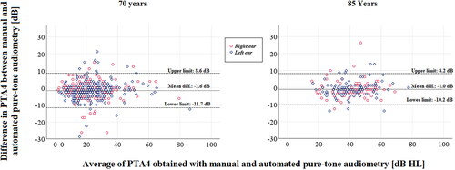 ijaonline's tweet photo. Accuracy of #automated #puretone audiometry in population-based samples of older #adults
#OpenAccess #NewArticle #IJA by Hoff, Göthberg, Tengstrand, Rosenhall, @ingmar_skoog & @AndreMSadeghi
#AuDpeeps #Audiology
https://t.co/iOop5Ma9XX https://t.co/L7ANPHhcBi