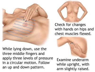 The best time to do a self breast exam is few days after your period when your breasts are not swollen or tender.

Examine with a soapy hand in the shower, so your hand glides smoothly over the surface. Also check your armpit.

Let's prevent breast cancer.

RT to help someone.