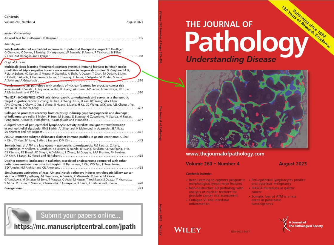 amit_sethi's tweet photo. Happy to report that our joint work with @KCDH_IITB @iitbombay, @KingsCollegeLon &amp; @TataMemorial on multi-resolution deep learning-based analysis of lymph nodes to predict outcomes in triple negative breast cancer has been featured on the cover of the latest issue of @JPathology. https://t.co/8aYNi85mdV