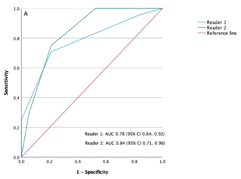 My thesis project on the clear cell likelihood score involving radiology residents demonstrated good performance in both the detection and exclusion of ccRCC. Another piece of evidence of ccLS's strength and validity!! Sincere thanks to Prof. <a href="/FDeCobelli/">FRANCESCO DE COBELLI</a> and Dr. <a href="/GiorgioBre/">Giorgio Brembilla</a>