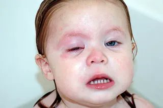 HomeopathyPlus's tweet photo. Dishwashing Liquid Remedy.
A quick-thinking Mum saved the day with a little homeopathy when running water did little to reduce the pain and swelling from detergent in a one-year-old's eyes.
https://t.co/vnoNQ4m2ly
#dishwashingliquid https://t.co/avQk8ICEoY