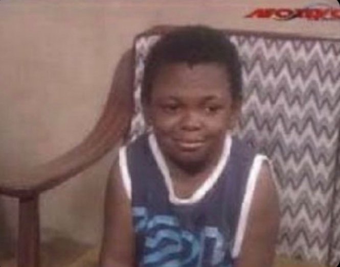 paul2ochigbo's tweet photo. So lack of sex the cause pimples and I'm here blaming innocent groundnut 🤣💔 https://t.co/CRbYIy7nZl