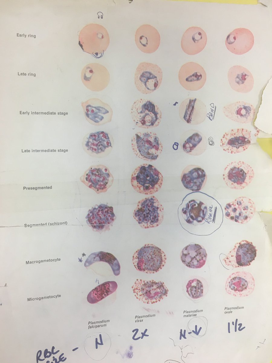 jeffIDfellows's tweet photo. Introducing our new fellows to one of the most sacred traditions in ID: micro rounds 
😊  

#malaria #IDfellows #micro #microrounds https://t.co/t0eBKkwtr4