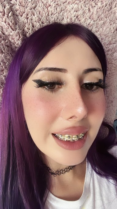 who else do you know has purple hair and braces, no one just me heueueye https://t.co/mWN10NbEUn