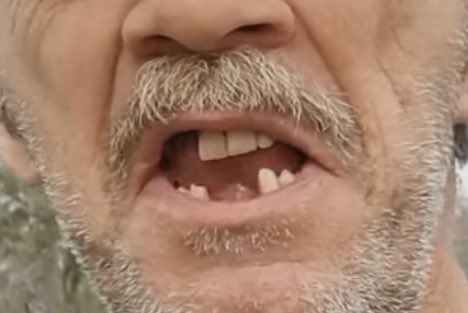 TikiCowboy's tweet photo. @AMCbiggums Dentists and proper oral hygiene are severely under appreciated these days. 🦷
#DontForgetToFloss @Crest @OralB https://t.co/kyju4rCBJd