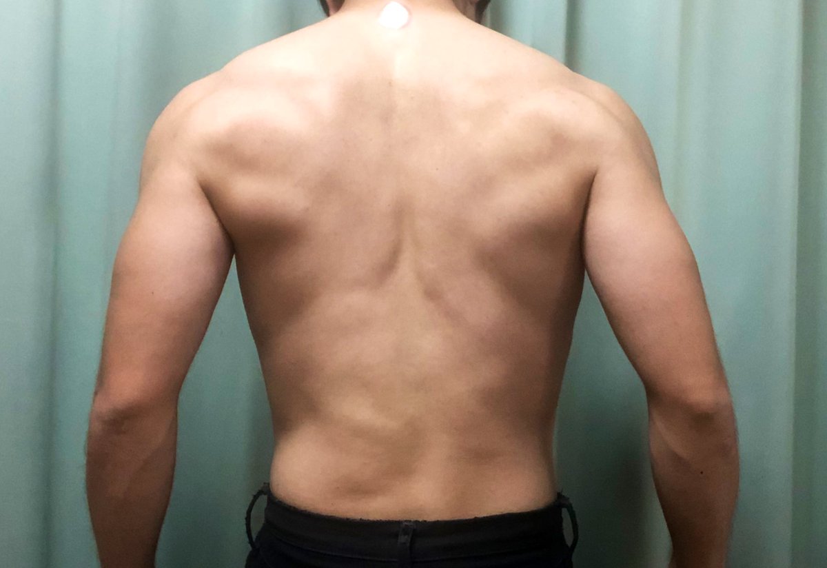 2023LR's tweet photo. #プリズナートレーニング
#キャリステニクス
#自重トレ
#ホームトレーニー
DAY1092

Bridge
・STEP10(2set×10reps)

Hand stand
・STEP3(1set×60s) 
・STEP4(2set×20reps)
・JackNifePU(1set×40reps)

Push up
・STEP6+22cm台 (2set×20reps)
・STEP6 (1set×43reps) https://t.co/1mZKDTjJBE