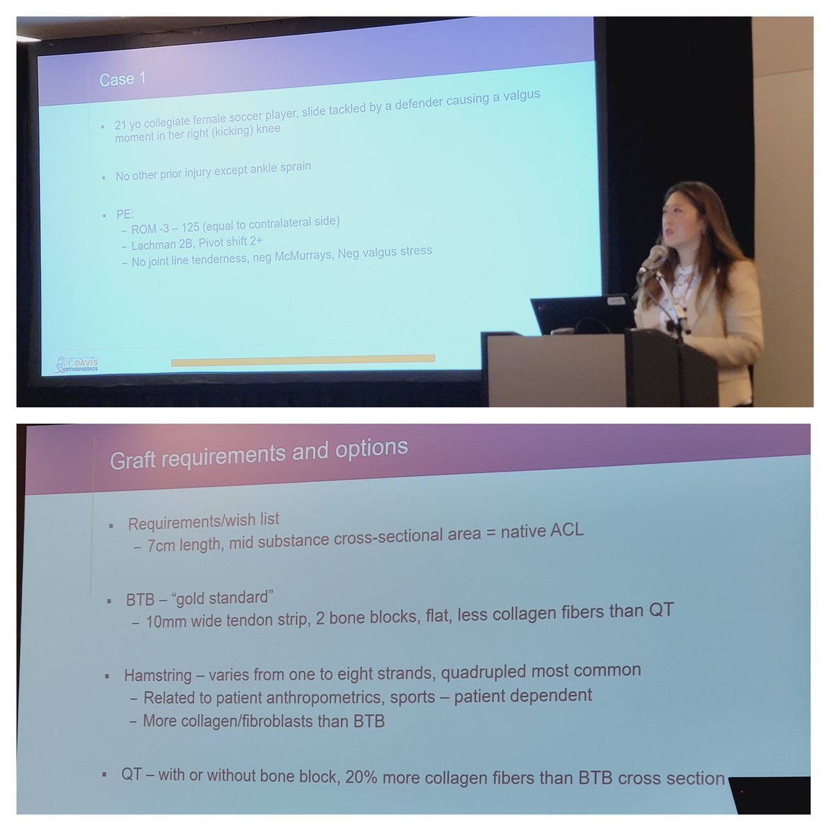 marykmulcaheymd's tweet image. Kicking off #AOSSM2023 with our ICL on optimizing #ACL reconstruction! 

✳️ BTB vs Hamstring vs Quad autograft
✳️ Evolution of quad autograft harvest technique
✳️ Augmenting ACL reconstruction with LET, ALL recon, &amp;amp;/or internal brace
#orthotwitter #laudthequad