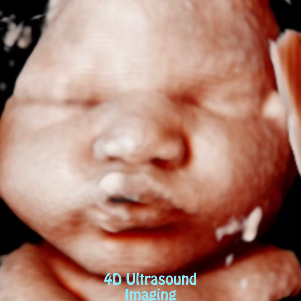 MiracleWomb's tweet photo. "Good morning! Experience the miracle of 3D, 4D, and 5D ultrasounds at Miracle in the Womb. Book now! #MiracleInTheWomb #Ultrasound" https://t.co/wJ7yRkXnn0