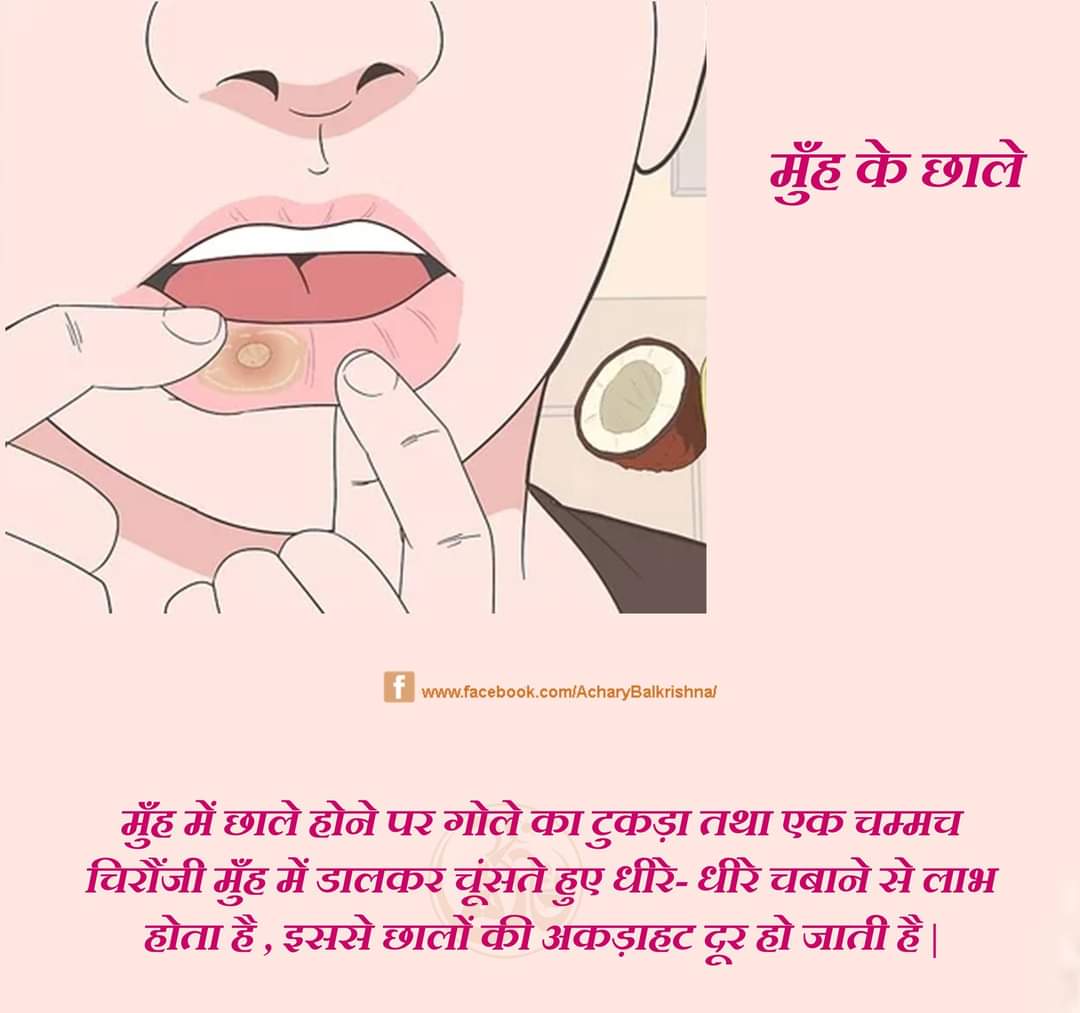 मुँह के छाले