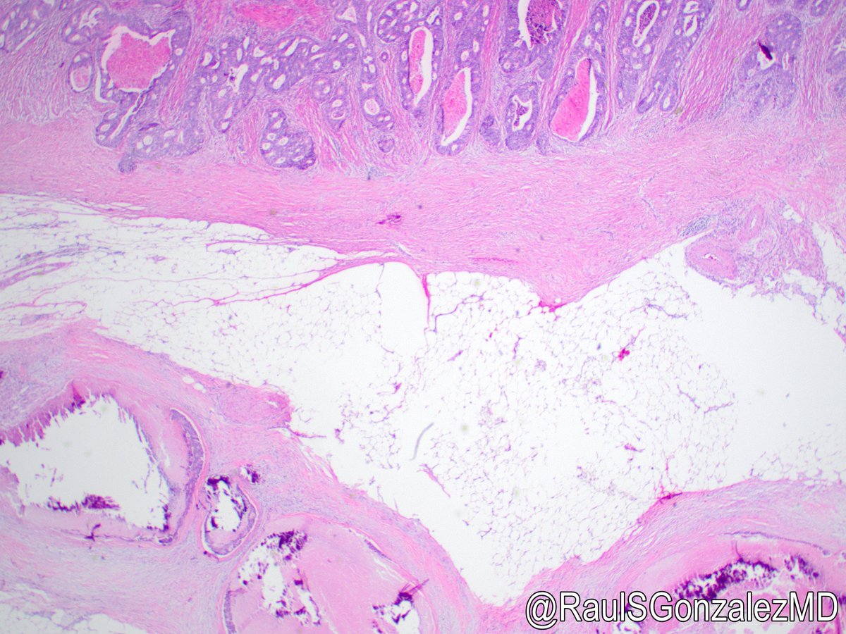 Raul S. Gonzalez, MD tweet media