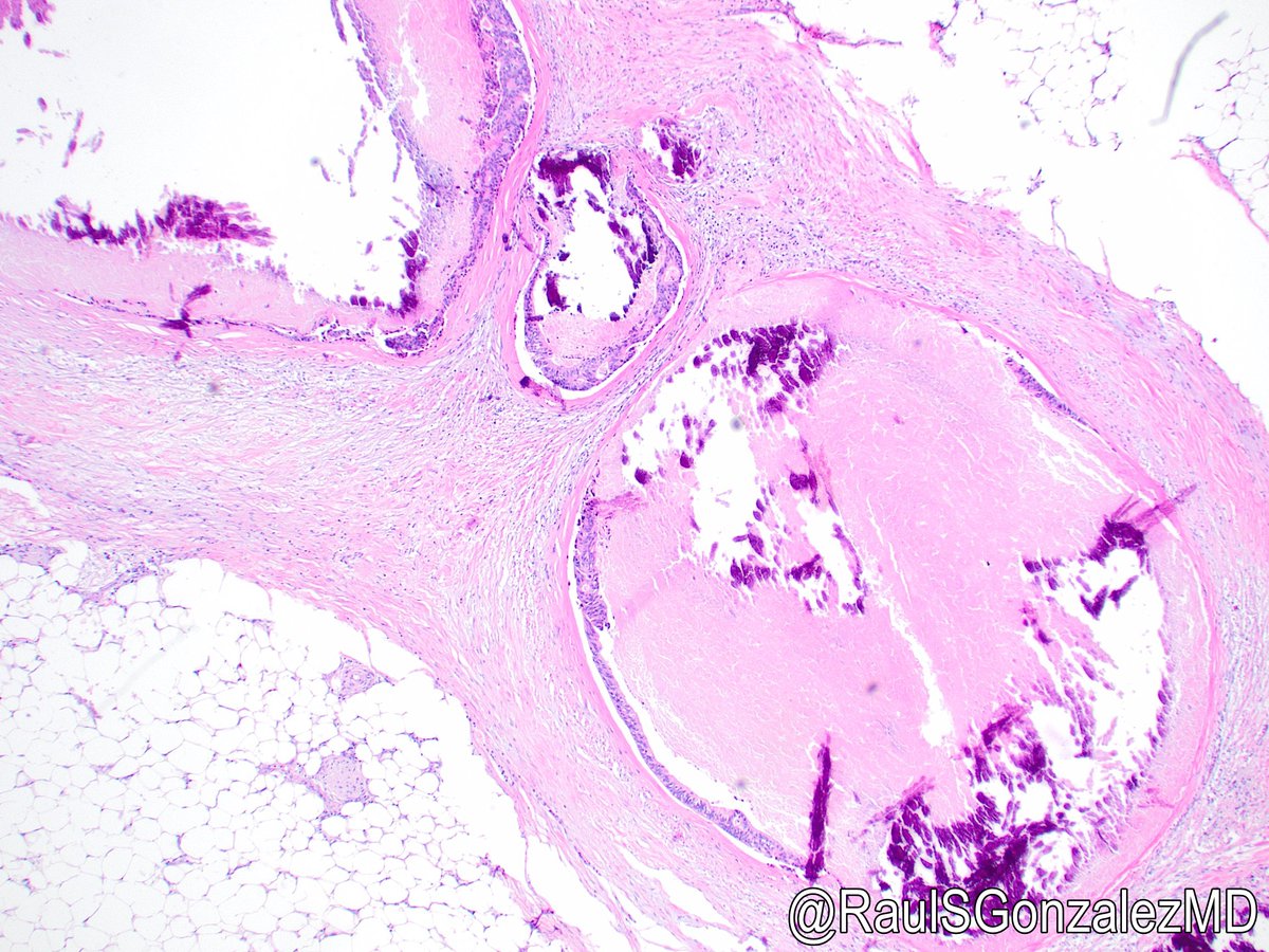 Raul S. Gonzalez, MD tweet media