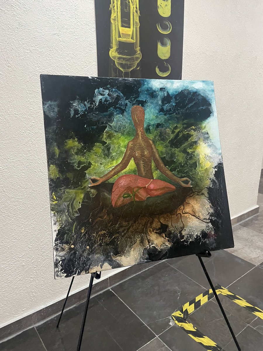 Arte en el congreso nacional de Hepatología 
<a href="/amhmx/">AMH</a>