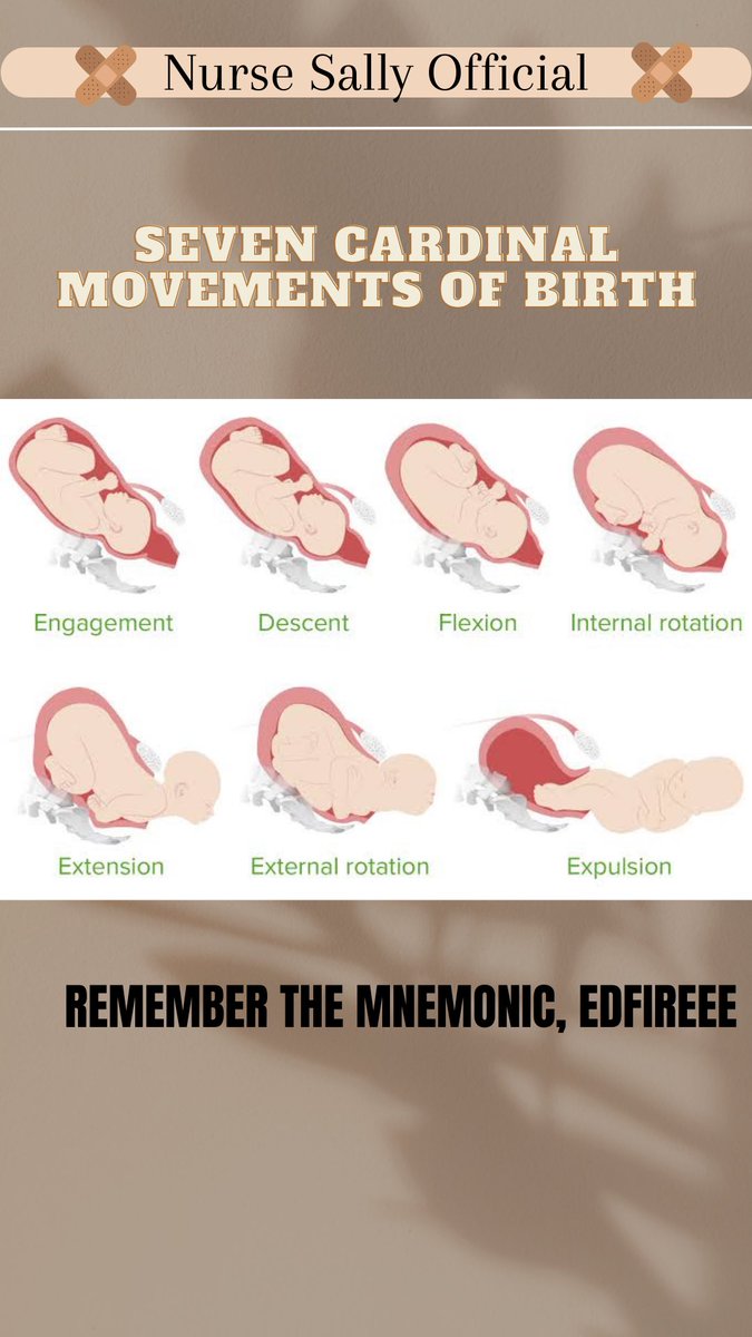 7 cardinal movements of labor explained - tastemoms