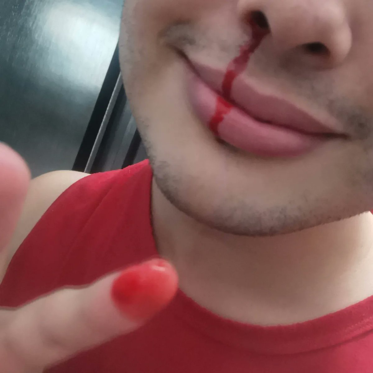 HctrZng's tweet photo. Me levanto, voy al baño, me veo al espejo y mi nariz me desconoció 😔 quiso proceder a desangrarse 🤧 https://t.co/9gCXRJhLBH