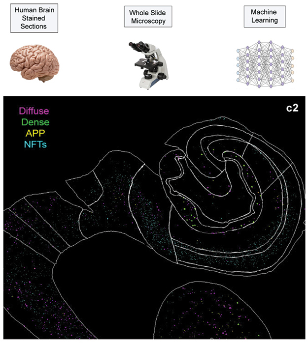 Lab of Neuro Imaging (@uscloni) on Twitter photo 📢 #AI is being used to analyze brain scans, neuropathology, protein folding, and to model #Alzheimers pathogenesis. Check out the new preprint and hear from <a href="/neuralmapping/">Michael S Bienkowski</a>! bit.ly/44vjwcY 📢 #AI is being used to analyze brain scans, neuropathology, protein folding, and to model #Alzheimers pathogenesis. Check out the new preprint and hear from <a href="/neuralmapping/">Michael S Bienkowski</a>! bit.ly/44vjwcY