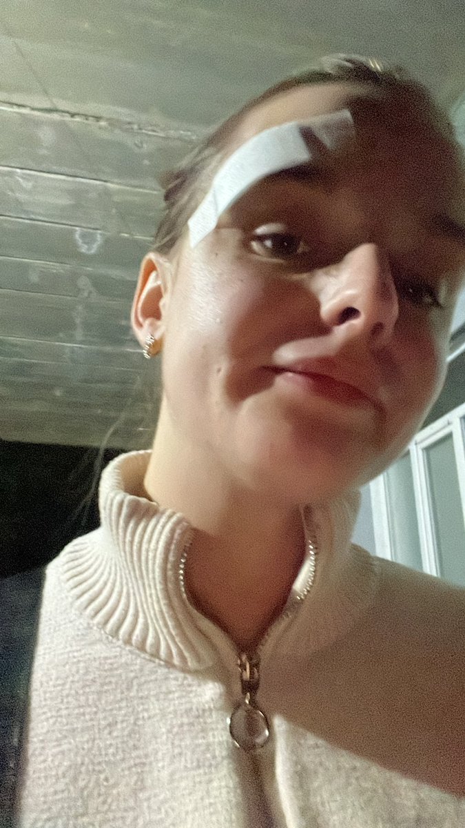 favorite_Archie's tweet photo. Из последнего
Расхерачилась на самокате,зашивали бровь🥲 https://t.co/oPYZVdKw8k
