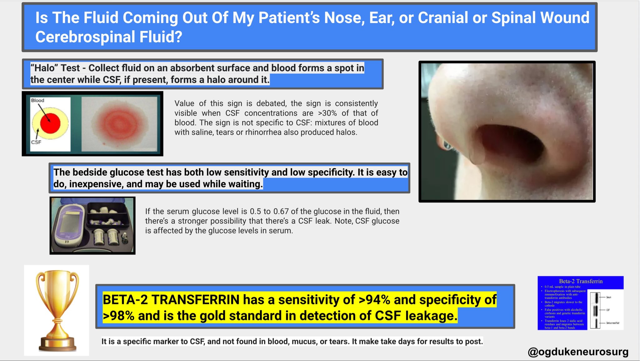 Oren Gottfried, MD on Twitter "Is Fluid Coming Out Of My Nose, Ear, or