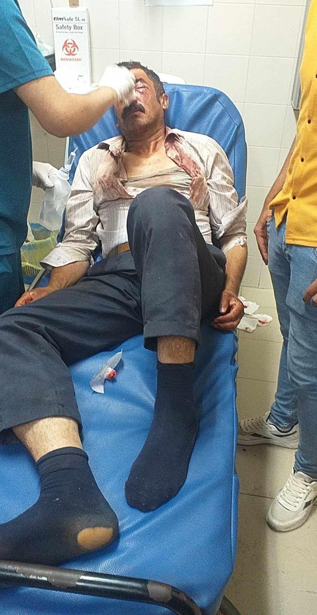 EyeonPalestine's tweet photo. 🇵🇸 #Palestine || Four Palestinians were injured during the attack of Israeli settlers at Palestinians in Kafr Thulth village, near Qalqilia city. 13.7.23 

اصابة اربعة مواطنين خلال هجوم المستوطنين في قرية كفر ثلث قضاء قلقيلة https://t.co/MpO3gRm8EB