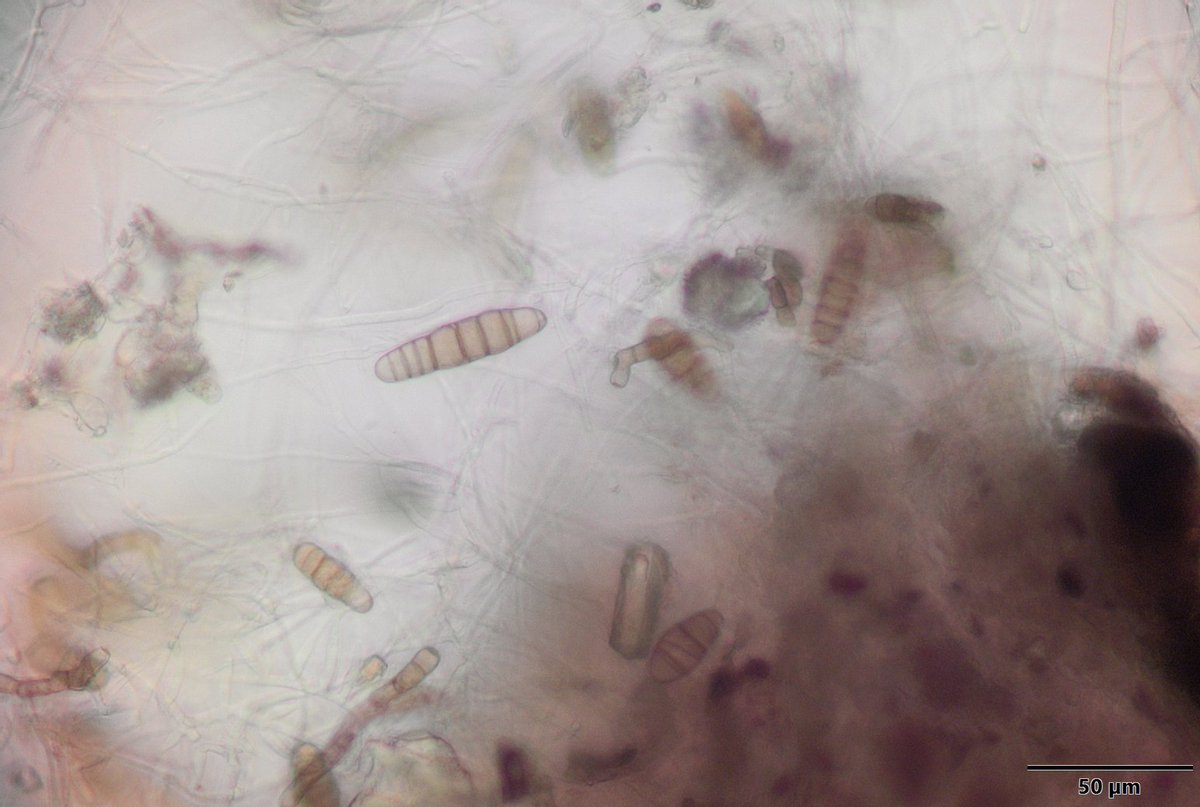 NCSU_PDIC's tweet image. Skin blotch disease suspected on garlic caused by Embellisia allii. We had to make sure to wash our cloves when we got home after dealing with this #fungalpathogen. #Ascomycota #garlicdiseases