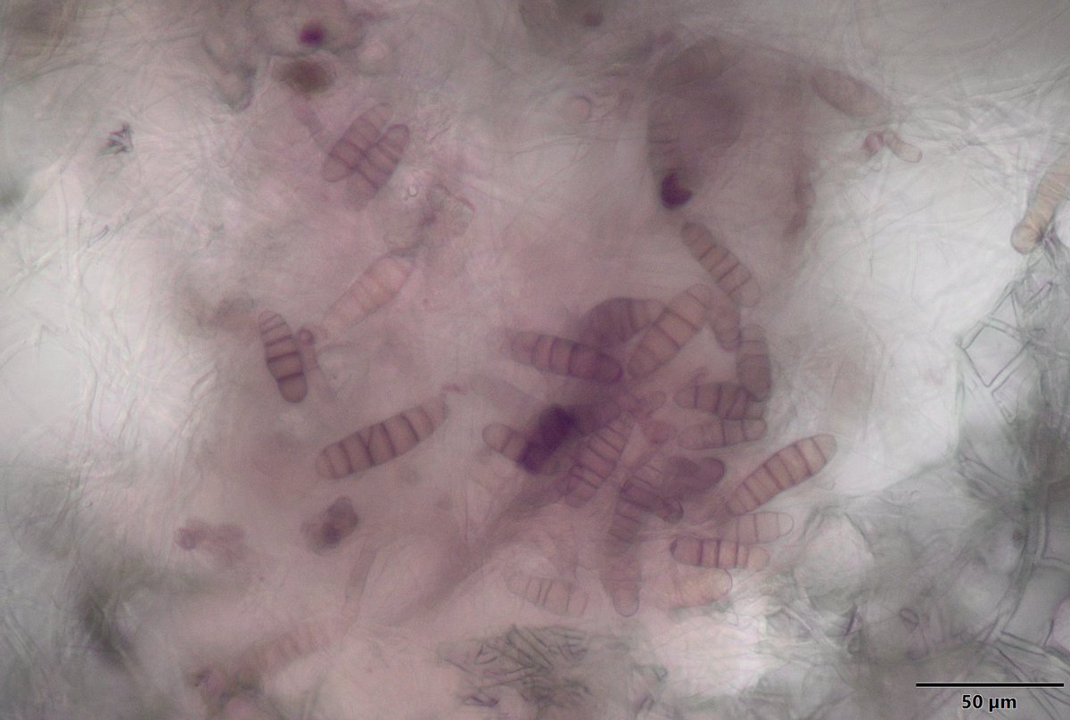 NCSU_PDIC's tweet image. Skin blotch disease suspected on garlic caused by Embellisia allii. We had to make sure to wash our cloves when we got home after dealing with this #fungalpathogen. #Ascomycota #garlicdiseases