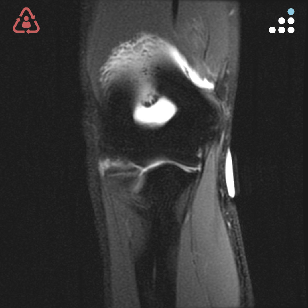 Orthobullets tweet media