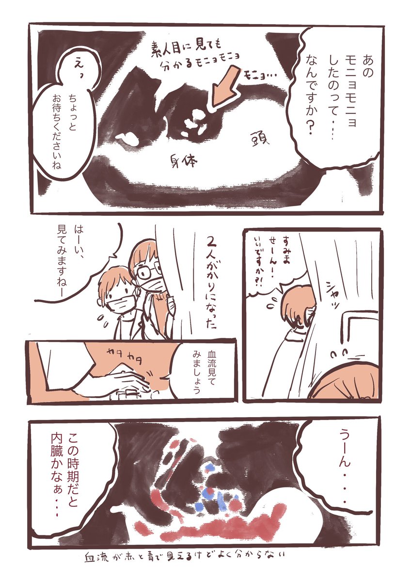 (再掲)妊娠中に胎児に異常が見つかった話。(1/2) 腹壁破裂で不安なお母さんに届いたら嬉しいです! 今はごはんおかわりして元気に暮らしています!