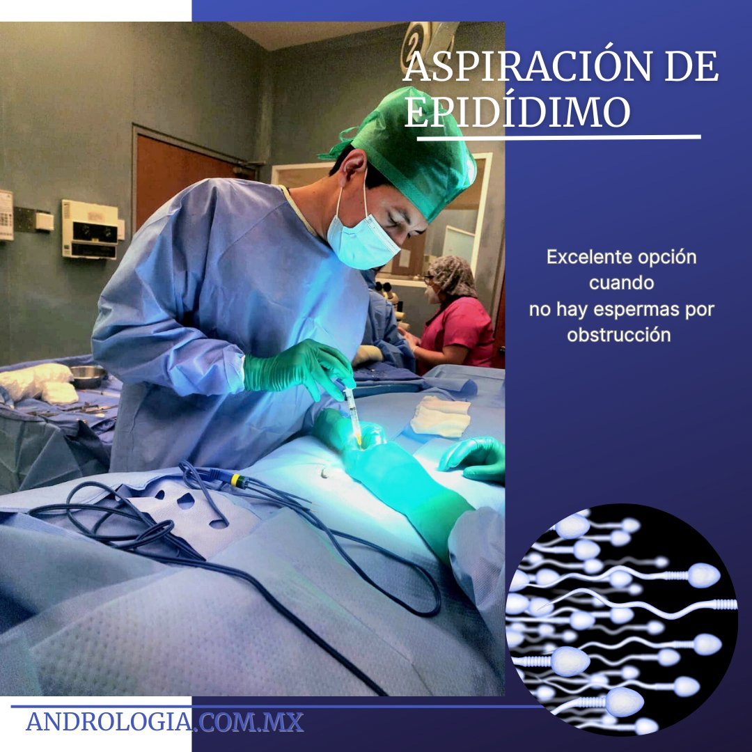 DrAxelCayetano's tweet photo. 1/5 🌟 ¡Descubre la Aspiración de Epidídimo! 🌟¿Sabías que la aspiración de epidídimo es un procedimiento médico que puede ayudar a hombres con problemas de fertilidad? 🧪👶 https://t.co/6ztsGzLnjg