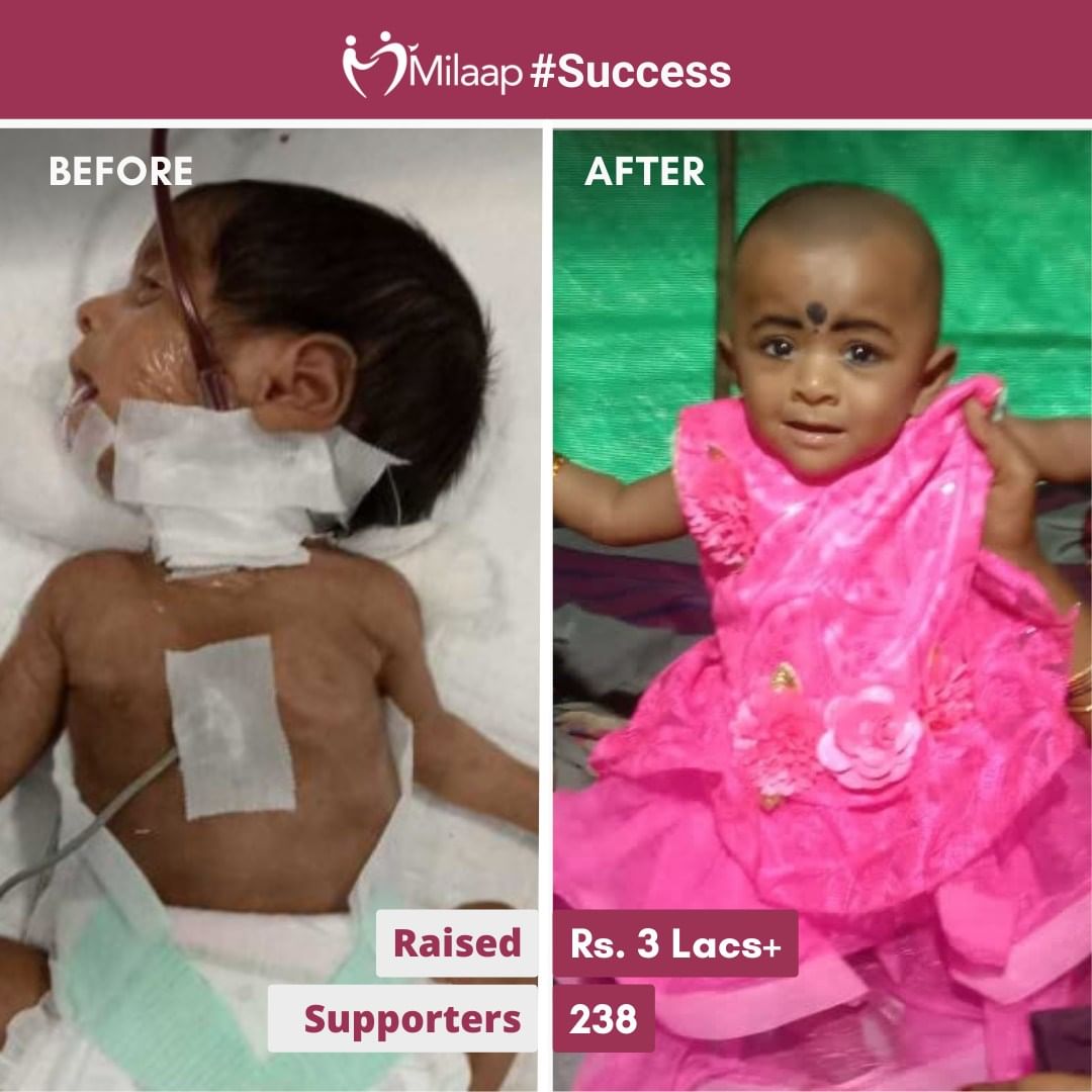 Against all odds, a tiny warrior's life was saved. This premature baby fought relentlessly, her spirit shining brighter than ever. In the face of adversity, her laborer father stood helpless, but thanks to the kindness of donors like you, hope was restored. #success #thankyou