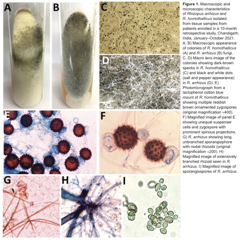 🔥R. homothallicus is fairly easy to differentiate from the more common R. arrhizus due to its zygospores. 🔥However it is being increasingly reported nowadays. 🔥thankfully it is associated with better survival and a good anti-fungal susceptibility profile.