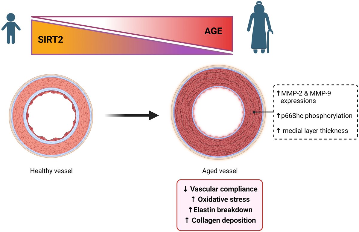 ehj_ed's tweet photo. Sirtuin 2 in vascular ageing: the forsaken child? Discover more in #EHJ:
https://t.co/y1dKz0be9j
#ageing #sirtuin #vasculature #CVD #cardiotwitter @escardio @ESC_Journals https://t.co/Dc8PQpLy29