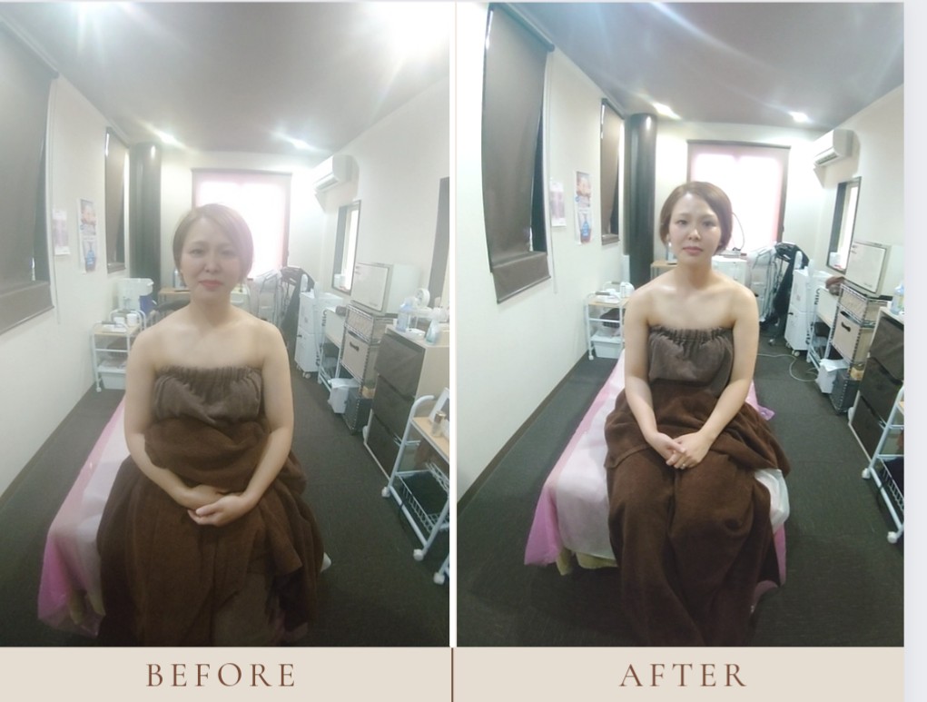 昨日は小顔リンパを5人のお客様にしましたが、小顔メニューをこんな人数したことがなかったのでエステティシャンの方は毎日こんな感じなのかと思いながら施術してました🤣
昨日された方はほんと別人みたいになりました🤭光加減が違いますが、ガチの無加工です!喜んで帰られて良かったです😊
#小顔#浜松