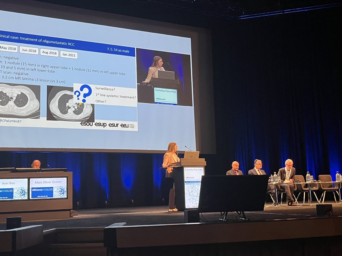 Stimulating case discussion on treatment of oligometastatic #KidneyCancer #UROonco23 Initial surveillance is often a reasonable approach before starting systemic treatment and SaBR has increasing role for treatment of mets @CPalumbo87 @MejeanArnaud @Raquib_Hannan Axel Bex