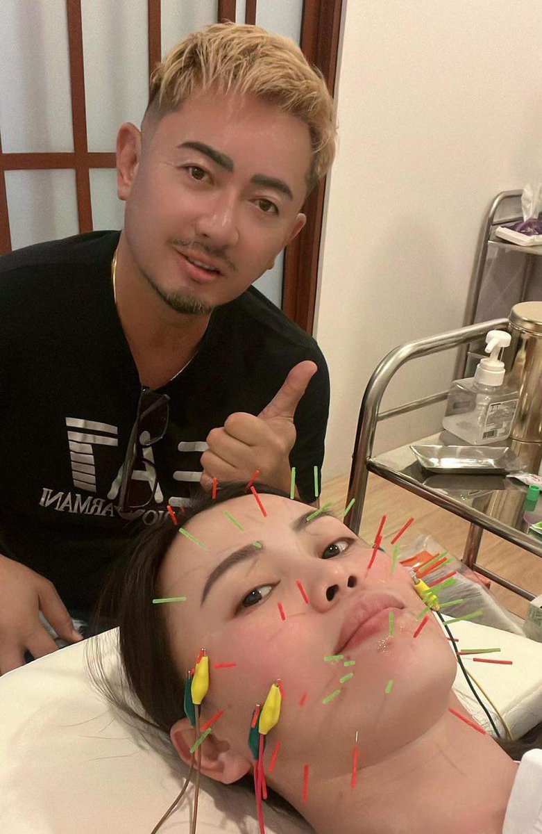 KokoMichi8's tweet photo. 妻から、”あごにニキビができたから顔に針して”と言われて美顔鍼。
#stressfree 
#hairgrowth
#pms #sleeping #migraine 
#acupuncture #philippines   #acupuncture #beauty #humanstemcells
#cosmetic #face #antiaging  #hormonal  #humanstemcell  #immunesystem #motivationmonday #sundayfunday https://t.co/VsavxFsZSL